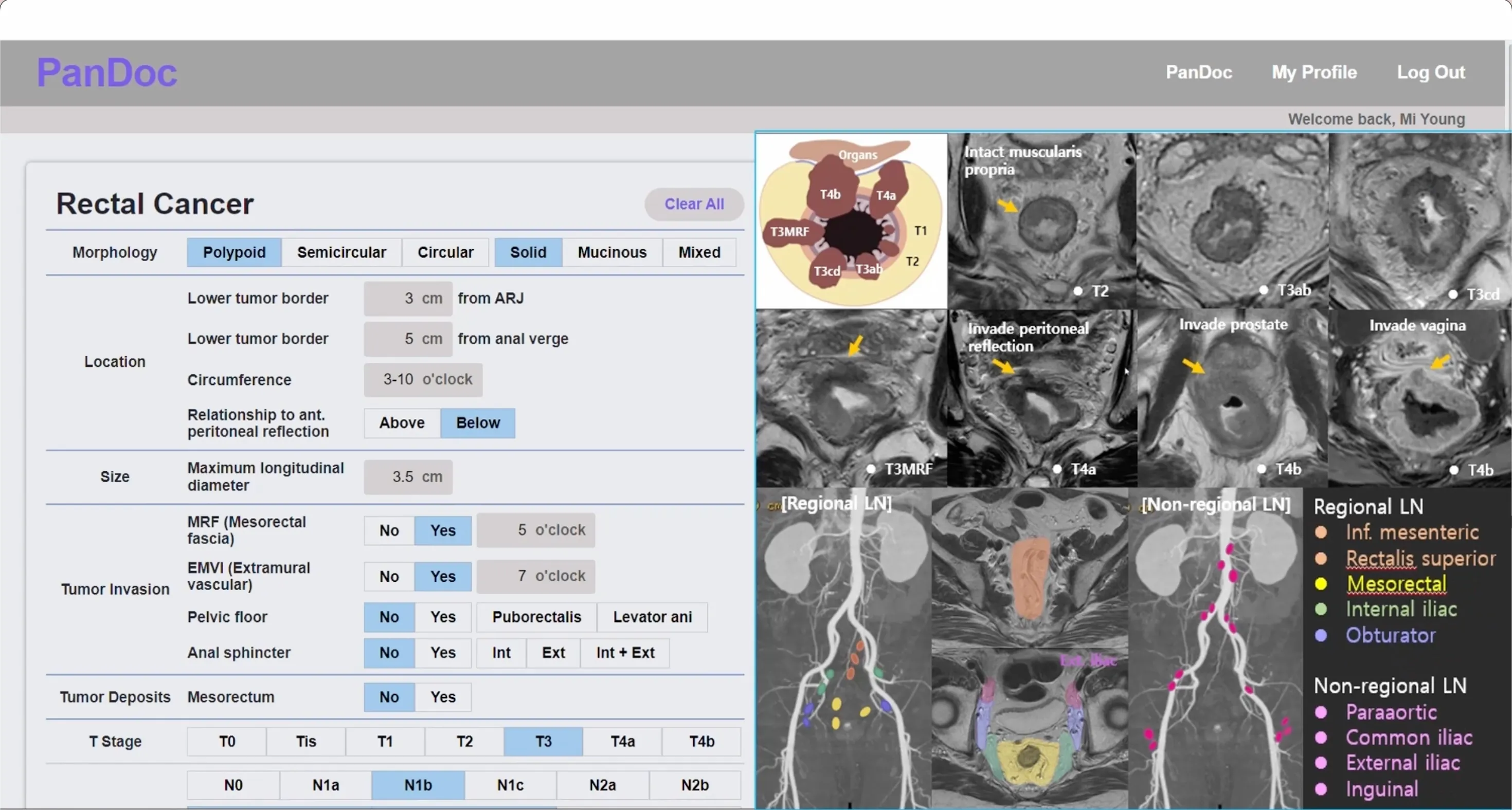 MediVu 프로토타입 스크린샷